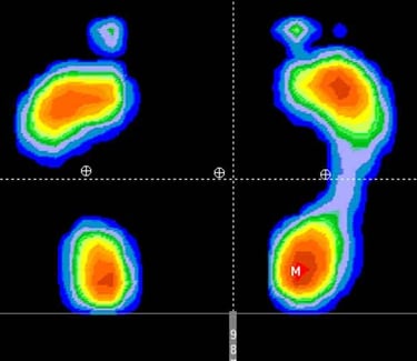estudio pisada marcha plantillas illescas toledo
