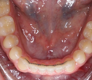 pictures of teeth