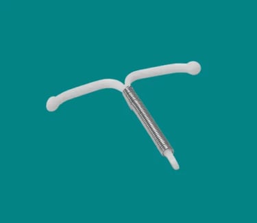 stérilet (DIU), contraception, recherchesante.com