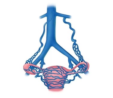 vascular ultrasound pelvic pain congestion syndrome vein venous chronic women reproductive ovarian ache vulval varice dull