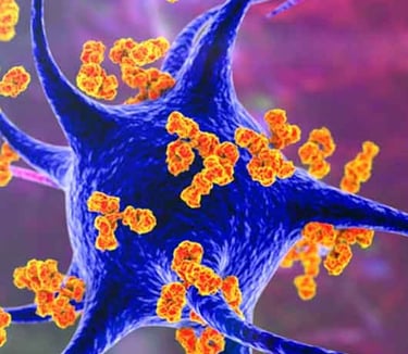 Autoimmune positive plasma