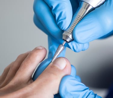 quiropodia, callos, uñas illescas