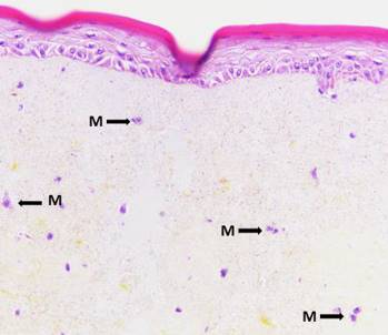 Microscopic view of skin tissue histology showing epidermis and melanocytes marked with labels.