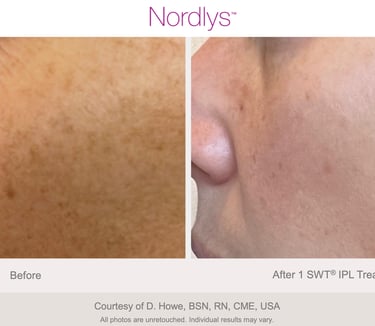 glowing and refreshed skin after rejuvenation treatment in Hamilton Ontario