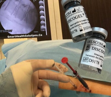 Discogel injection , Discogel vial