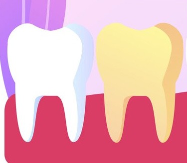 causes déminéralisation des dents soins jet dentaire ozone aquolab hygiene-precision