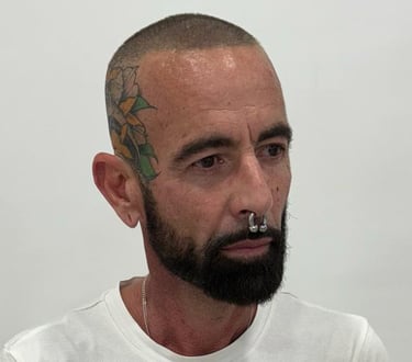 Tratamiento capilar avanzado contra alopecia