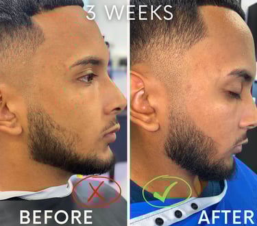 Before and after beard growth