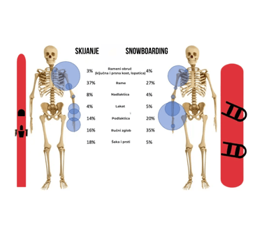 Je li opasnije skijanje ili snowboarding?