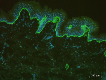 Human skin cells are produced at CTIBIOTECH biobank