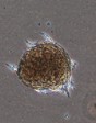Dermal Papilla from CTIBIOTECH ethical cell cultures