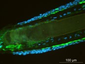 Human hair follicles from CTIBIOTECH biobank