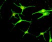 Human melanocytes produced at CTIBIOTECH biobank