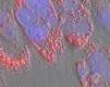 Human sebocytes produced at CTIBIOTECH biobank biosourcing