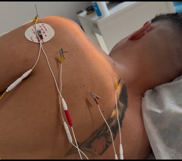 Neuromodelação funcional