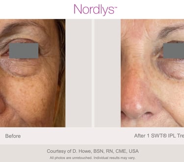 skin consultation session at skincare clinic in Hamilton Ontario