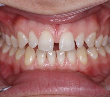 pictures of teeth