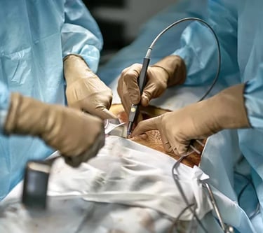 Centro Médico pionero en Cirugía Láser, IMV, Cambrils, Tarragona,
