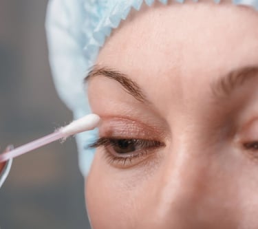 blefaroplastica non chirurgica trento rovereto verona bolzano