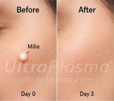 _ultra_plasma_ultra_plazma_ultra-plasma_ultra-plazma