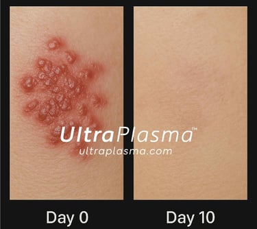 _ultra_plasma_ultra_plazma