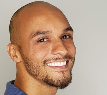 Paciente após tratamento completo de resinas estéticas com o método Resinalign na Sannre Odontologia