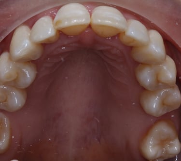 pictures of teeth