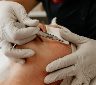 dermaplanning