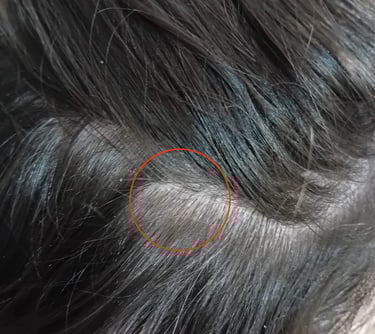 image de la même zone de sécheresse après l'application de l'argile.