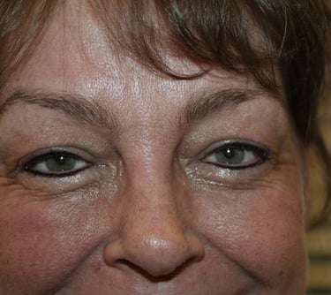 Client with permanent Eyeliner