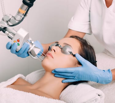 A woman receiving a CO2 laser treatment for skin rejuvenation and acne scar treatment in Vadodara