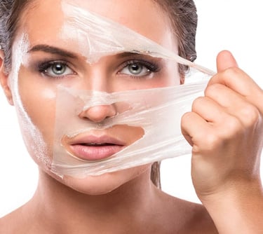  Image of woman receiving face pigmentation treatment in Vadodara, peeling on face during chemical peeling