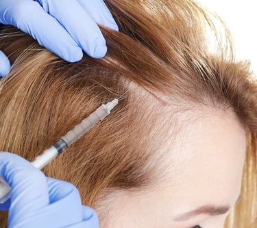 PRP treatment in Vadodara: Expert dermatologist offers the best solution for hair fall. 