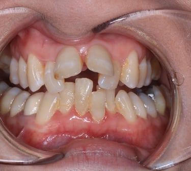 pictures of teeth