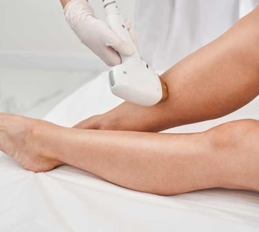 Nova - Permanent Ontharen