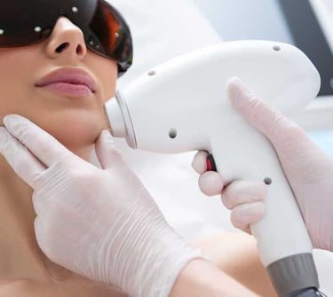 Nova - Permanent Ontharen