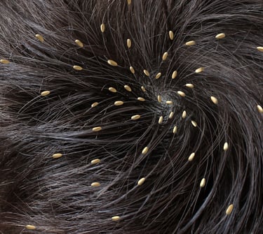 Top skin specialist and dermatologist in Vadodara offering headlice treatment and hair care services