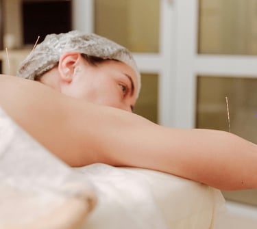 Pain Relief: Holistic acupuncture for natural relief from chronic pain and tension