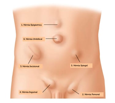 paredeabdominal