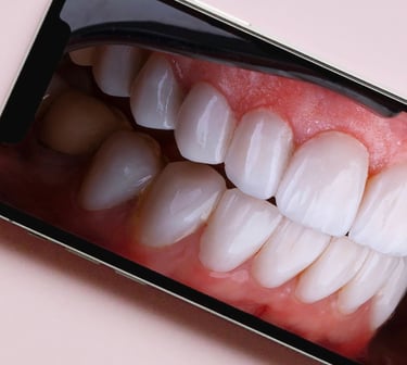 odontologinės fotografijos mokymai išmaniuoju telefonu