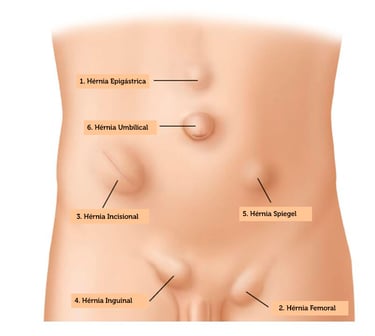 paredeabdominal