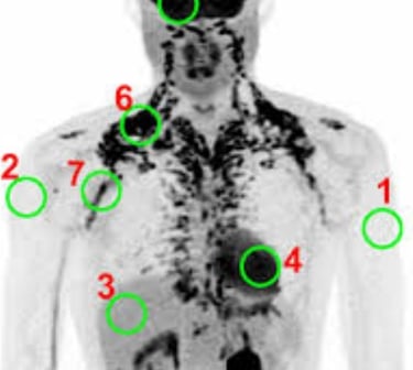 ❄️Accurate Evaluating Brown Adipose Tissue 