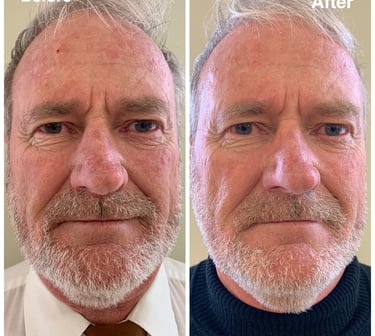 Before and after of man aging younger