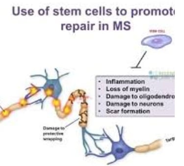 stem therapy use = fasting