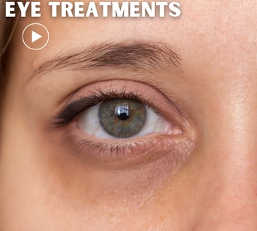 a woman with tired eye 