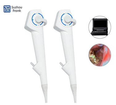 Disposable Choledochoscope Single-Use Sterile Endoscope for Bile Duct Exploration and Stone Removal