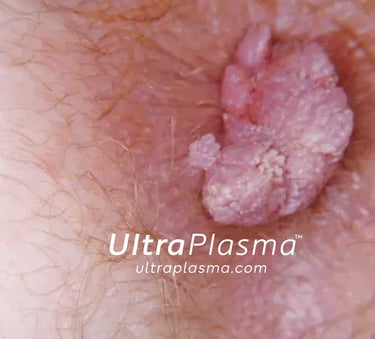 _ultra_plasma_ultra_plazma_ultra-plasma_ultra-plazma