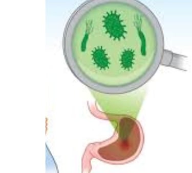 جرثومة المعدة علاج