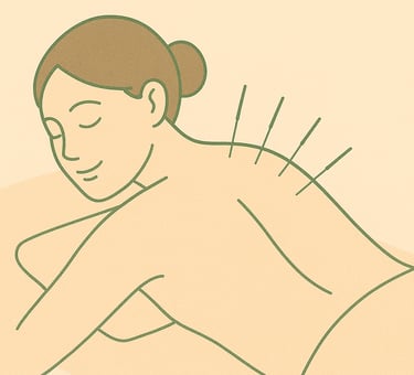 acupuncture