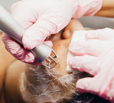 pico laser fractional laser ablative laser for acne scars